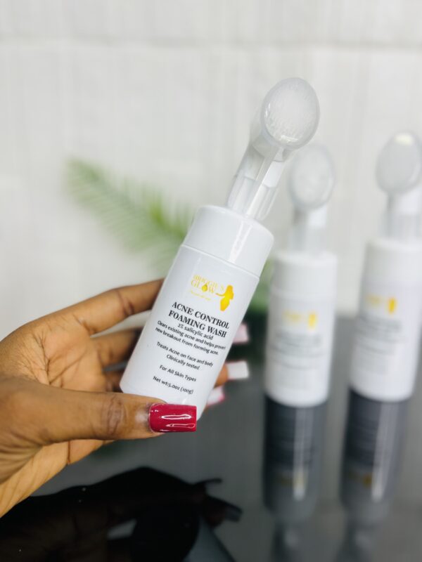 ACNE FOAMING FACE WASH